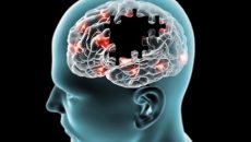 Pie de foto: Un conglomerado anormal de la proteína Tau (la cual actúa como enlace del puente que lleva pensamientos y recuerdos), llamado depósito o placa amiloide, característicos en la enfermedad de Alzheimer, y en los que se hallan altas concentraciones de cobre, hierro y zinc (Foto: tomada de i2.wp.com/secuenciasalud.com.)