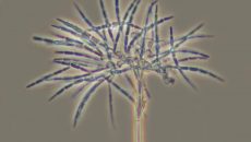 En la imagen, hongo microscópico saprobio Speirosis scopiformis visto a través del microscopio. Estos organismos son un recurso de alto potencial biotecnológico. (Foto: cortesía Dr. Gabriela Heredia Abarca.)