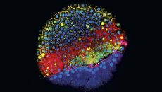 Un embrión de pez cebra en una etapa temprana de desarrollo. Los marcadores fluorescentes resaltan las células que expresan genes que ayudan a determinar el tipo de célula en que se convertirán. (Foto: Jeffrey Farrell, Schier Lab/Harvard University.)