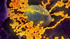 Esta imagen de microscopio electrónico de barrido muestra al SARS-CoV-2 (objetos de oro redondos) emergiendo de la superficie de células cultivadas en el laboratorio. El SARS-CoV-2 es el virus que causa el COVID-19. El virus que se muestra fue aislado de un paciente en los EE.UU. Imagen: NIAID-RML