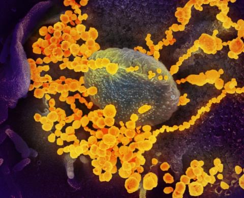 Esta imagen de microscopio electrónico de barrido muestra al SARS-CoV-2 (objetos de oro redondos) emergiendo de la superficie de células cultivadas en el laboratorio. El SARS-CoV-2 es el virus que causa el COVID-19. El virus que se muestra fue aislado de un paciente en los EE.UU. Imagen: NIAID-RML